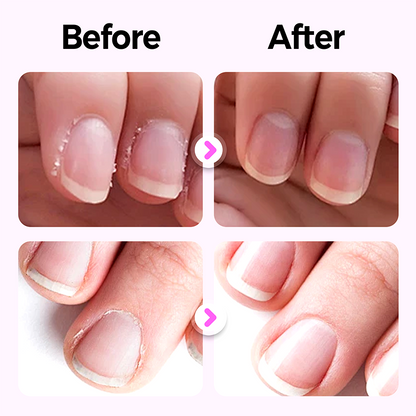 BUY 1 GET 1 FREE💅3-in-1 Nail Care Pen